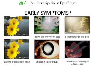 EARLY SYMPTOMS?
Southern Specialist Eye Centre
 
