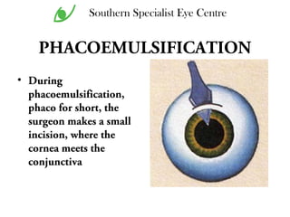 PHACOEMULSIFICATION
• During
phacoemulsification,
phaco for short, the
surgeon makes a small
incision, where the
cornea meets the
conjunctiva
Southern Specialist Eye Centre
 