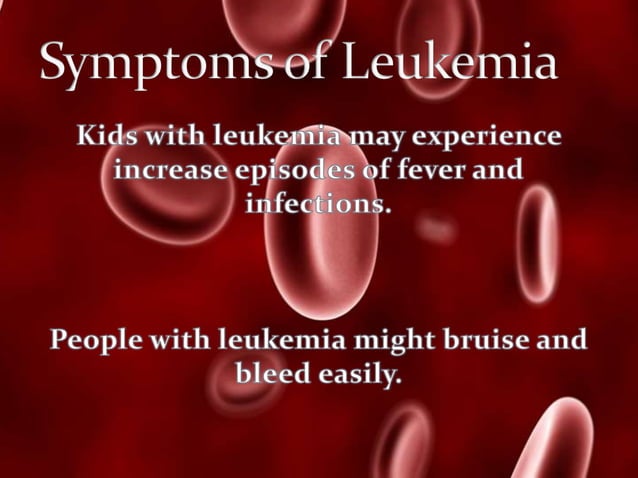 leukemia-powepoit-presentation