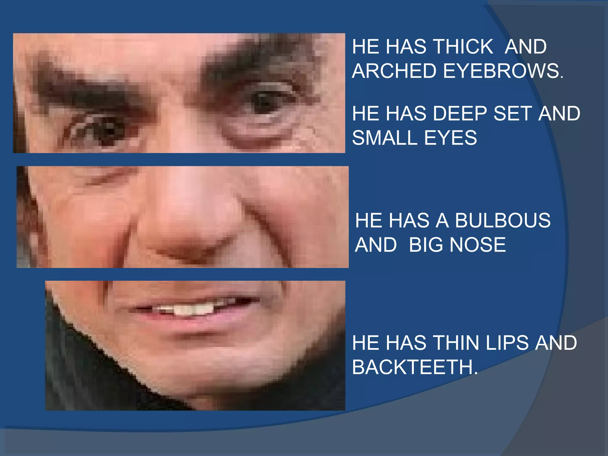 HE HAS THIN LIPS AND
BACKTEETH.
HE HAS THICK AND
ARCHED EYEBROWS.
HE HAS DEEP SET AND
SMALL EYES
HE HAS A BULBOUS
AND BIG NOSE
 
