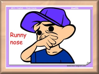 Runny nose 