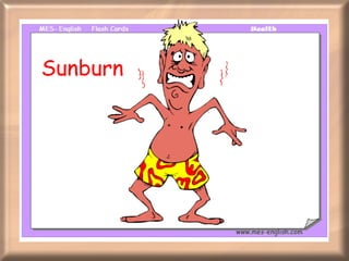 Sunburn 