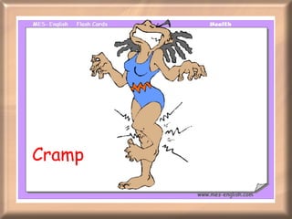 Cramp 