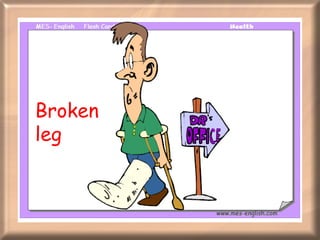 Broken leg 