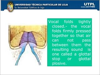13
Vocal folds tightly
closed.- the vocal
folds firmly pressed
together so that air
can not pass
between them the
resulting sound is
one called a glottal
stop or glottal
plosive.
 
