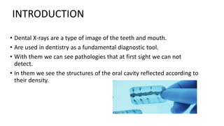 • Dental X-rays are a type of image of the teeth and mouth.
• Are used in dentistry as a fundamental diagnostic tool.
• With them we can see pathologies that at first sight we can not
detect.
• In them we see the structures of the oral cavity reflected according to
their density.
INTRODUCTION
 