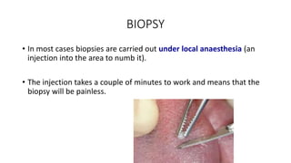 BIOPSY
• In most cases biopsies are carried out under local anaesthesia (an
injection into the area to numb it).
• The injection takes a couple of minutes to work and means that the
biopsy will be painless.
 