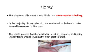 BIOPSY
• The biopsy usually leaves a small hole that often requires stitching.
• In the majority of cases the stitches used are dissolvable and take
around two weeks to disappear.
• The whole process (local anaesthetic injection, biopsy and stitching)
usually takes around 15 minutes from start to finish.
 
