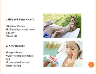 1. Bite and Burn Relief :
•Bitten or Burned
•Rub toothpaste and leave
it to dry
•Wash off
2. Acne Remedy
•Pimple formed
•Apply toothpaste before
bed
•Reduced redness and
faster healing
 