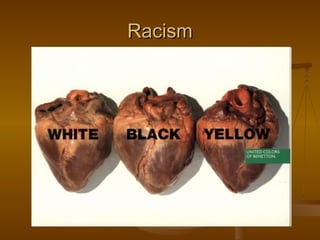 Racism
 