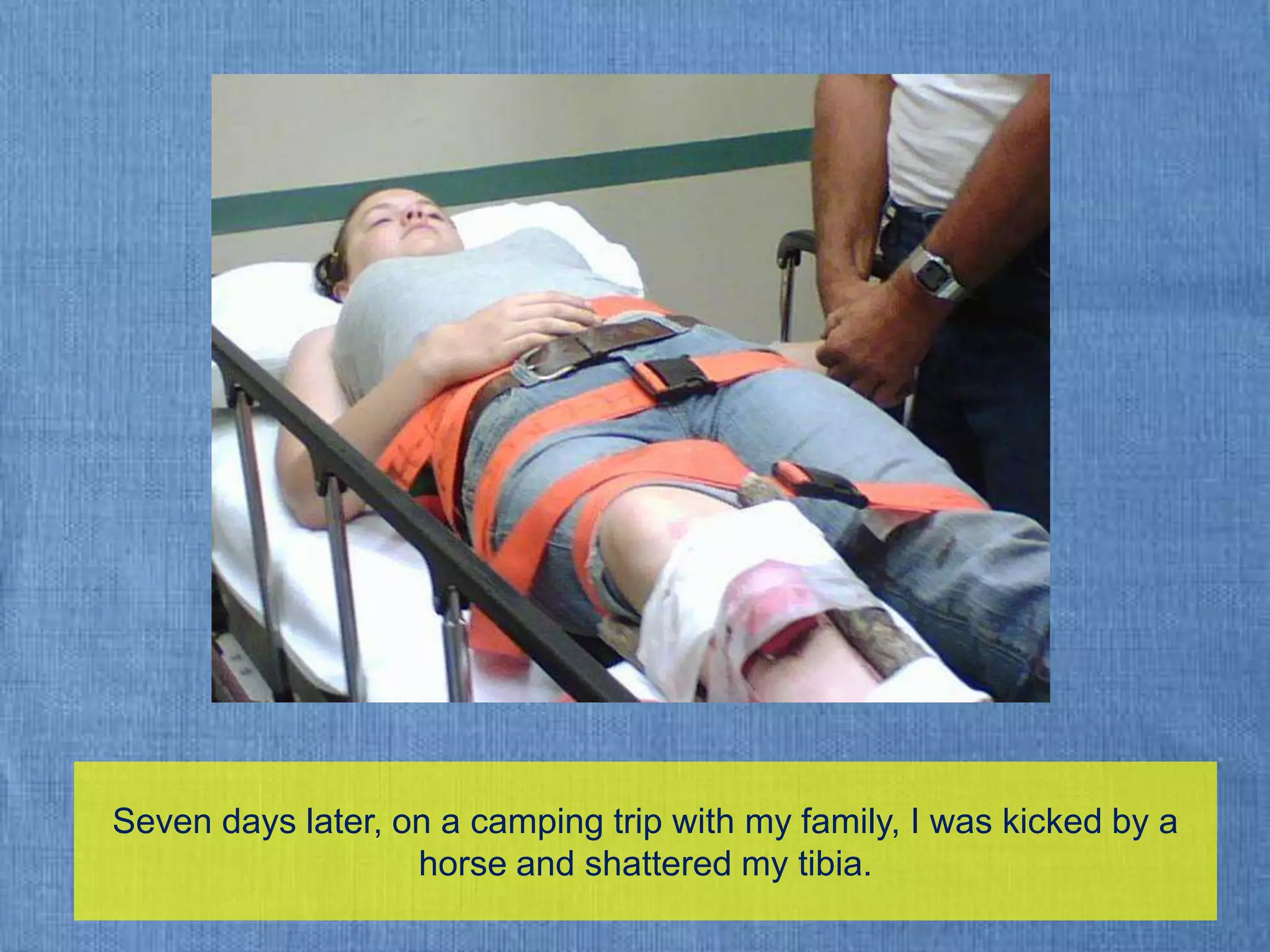 Seven days later, on a camping trip with my family, I was kicked by a horse and shattered my tibia.
