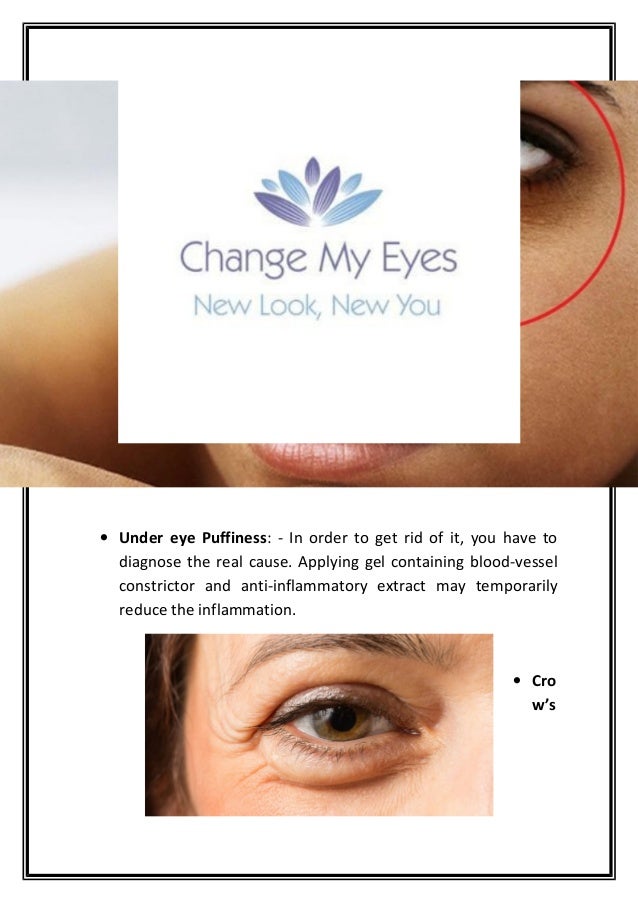 Enhance Beauty Of Your Eyes With Blue Eye Drops