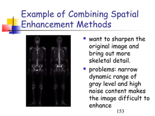 Example of Combining Spatial
Enhancement Methods
                 want to sharpen the
                  original image and
                  bring out more
                  skeletal detail.
                 problems: narrow
                  dynamic range of
                  gray level and high
                  noise content makes
                  the image difficult to
                  enhance
                           153
 