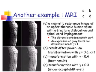 a    b
Another example : MRI                   c    d
         (a) a magnetic resonance image of
            an upper thoracic human spine
            with a fracture dislocation and
            spinal cord impingement
               The picture is predominately dark
               An expansion of gray levels are
                desirable  needs γ < 1
         (b) result after power-law
             transformation with γ = 0.6, c=1
         (c) transformation with γ = 0.4
             (best result)
         (d) transformation with γ = 0.3
             (under acceptable level)
                             21
 