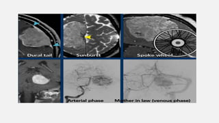 Basic Cns Pattern ENHANCMENT PATTERNS IN CNS................pptx