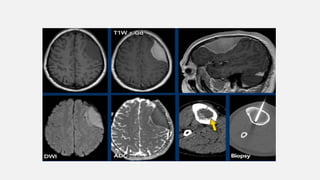 Basic Cns Pattern ENHANCMENT PATTERNS IN CNS................pptx