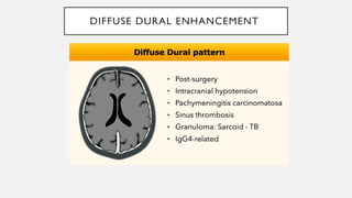 Cns Pattern ENHANCMENT PATTERNS IN CNS................pptx