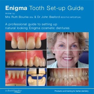 Products and training for better dentistry
Enigma Tooth Set-up Guide
Written by
Mrs Ruth Bourke BSc & Dr John Besford BDS PhD MFGDP(UK)
A professional guide to setting up
natural looking Enigma cosmetic dentures
 