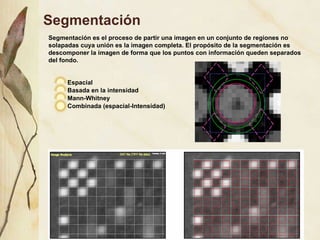 Segmentaci ón Espacial Basada en la intensidad Mann-Whitney Combinada (espacial-Intensidad) Segmentación es el proceso de partir una imagen en un conjunto de regiones no solapadas cuya unión es la imagen completa. El propósito de la segmentación es descomponer la imagen de forma que los puntos con información queden separados del fondo. 
