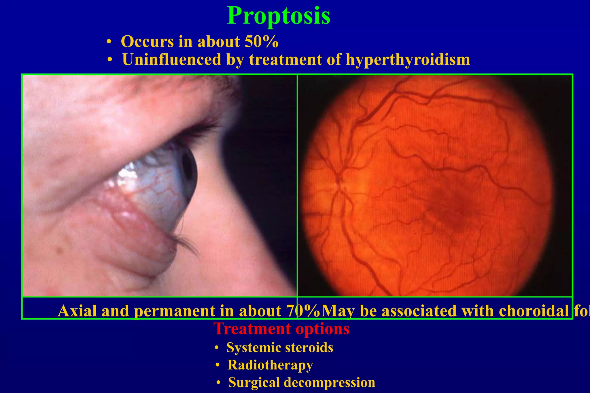 Ophthalmic Manifestations of Systemic Disorders | PPT