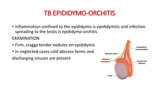 DIFFERENTIAL DIAGNOSIS OF INGUINOSCROTAL SWELLING | PPTX
