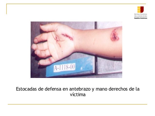 ENJ-300 Heridas por Armas Blancas
