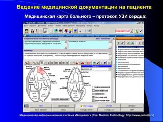 Ведение медицинской документации на пациента Медицинская информационная система «Медиалог» ( Post Modern Technology, http://www.pmtech.ru ) Медицинская карта больного – протокол УЗИ сердца: 