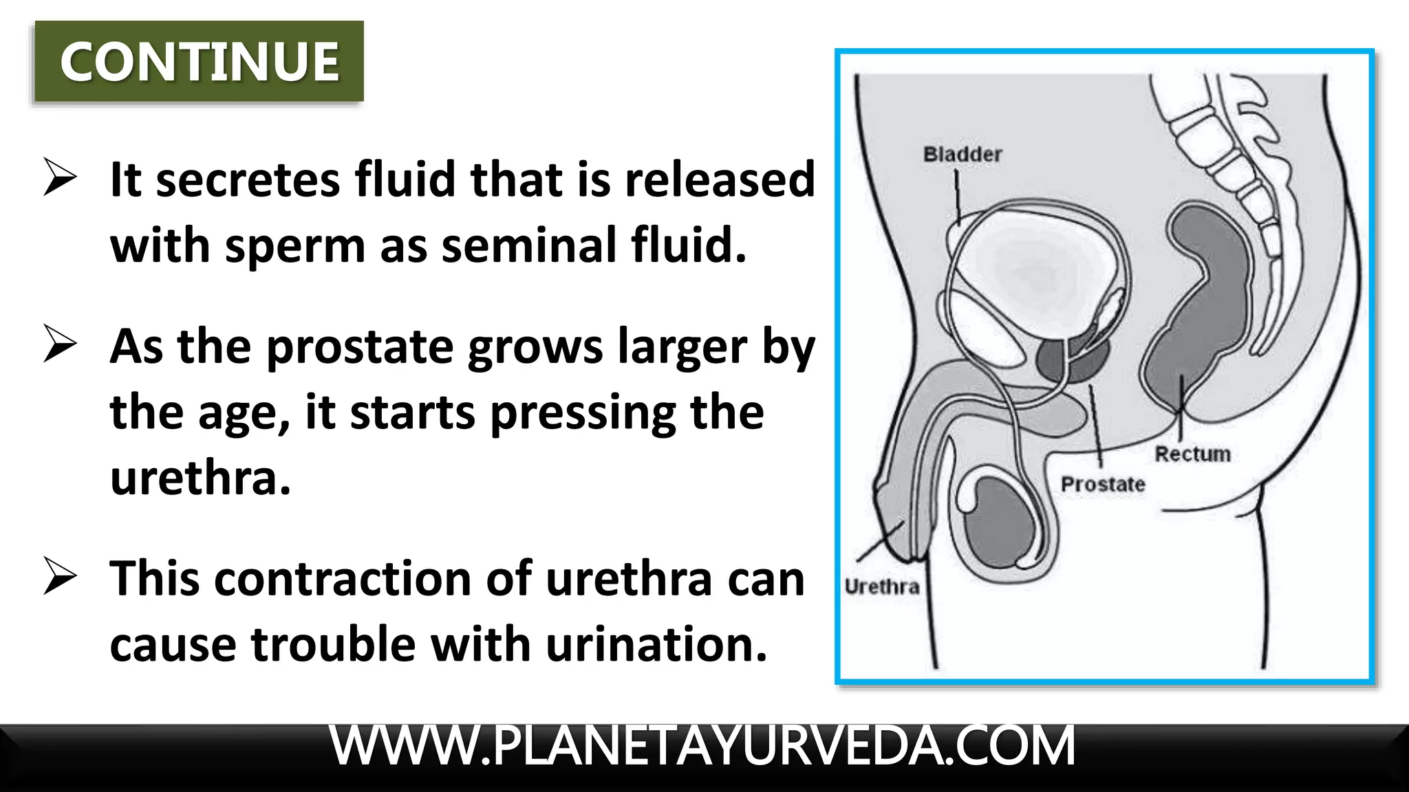 Prostrate Fluid Enlarged Prostate Gland - Diet, Lifestyle and Natural Treatment | PPTX