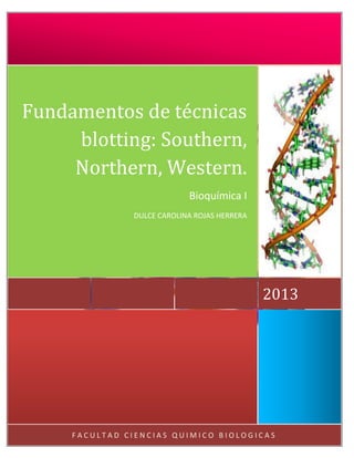Fundamentos de técnicas
blotting: Southern,
Northern, Western.
Bioquímica I
DULCE CAROLINA ROJAS HERRERA

2013

FACULTAD CIENCIAS QUIMICO BIOLOGICAS

 