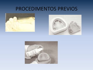 PROCEDIMENTOS PREVIOS
 