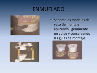 ENMUFLADO
• Separar los modelos del
yeso de montaje
aplicando ligeramente
un golpe y conservando
las guías de montaje.
 