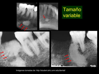 Tamaño
                                                    variable




Imágenes tomadas de: http://student.ahc.umn.edu/dental/
 