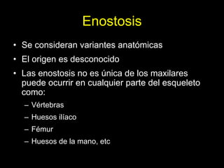 Enostosis
• Se consideran variantes anatómicas
• El origen es desconocido
• Las enostosis no es única de los maxilares
  puede ocurrir en cualquier parte del esqueleto
  como:
  – Vértebras
  – Huesos ilíaco
  – Fémur
  – Huesos de la mano, etc
 