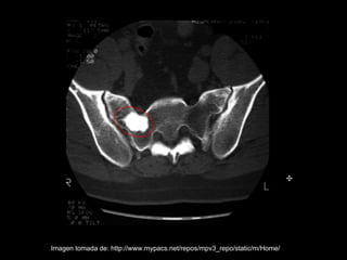 Imagen tomada de: http://www.mypacs.net/repos/mpv3_repo/static/m/Home/
 