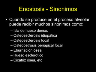 Enostosis - Sinonimos
• Cuando se produce en el proceso alveolar
  puede recibir muchos sinonimos como:
  – Isla de hueso denso.
  – Osteoesclerosis idiopática
  – Osteoesclerosis focal
  – Osteopetrosis periapical focal
  – Eburnación ósea
  – Hueso esclerótico
  – Cicatriz ósea, etc
 