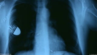 Pic - Christophe LachnittChristopheLachnitt.com
 