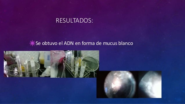 Que a mí hacer con un pequeño miembro