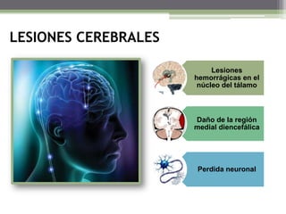 LESIONES CEREBRALES
Lesiones
hemorrágicas en el
núcleo del tálamo

Daño de la región
medial diencefálica

Perdida neuronal

 