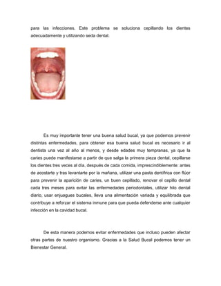 para las infecciones. Este problema se soluciona cepillando los dientes
adecuadamente y utilizando seda dental.




      Es muy importante tener una buena salud bucal, ya que podemos prevenir
distintas enfermedades, para obtener esa buena salud bucal es necesario ir al
dentista una vez al año al menos, y desde edades muy tempranas, ya que la
caries puede manifestarse a partir de que salga la primera pieza dental, cepillarse
los dientes tres veces al día, después de cada comida, imprescindiblemente: antes
de acostarte y tras levantarte por la mañana, utilizar una pasta dentífrica con flúor
para prevenir la aparición de caries, un buen cepillado, renovar el cepillo dental
cada tres meses para evitar las enfermedades periodontales, utilizar hilo dental
diario, usar enjuagues bucales, lleva una alimentación variada y equilibrada que
contribuye a reforzar el sistema inmune para que pueda defenderse ante cualquier
infección en la cavidad bucal.




      De esta manera podemos evitar enfermedades que incluso pueden afectar
otras partes de nuestro organismo. Gracias a la Salud Bucal podemos tener un
Bienestar General.
 