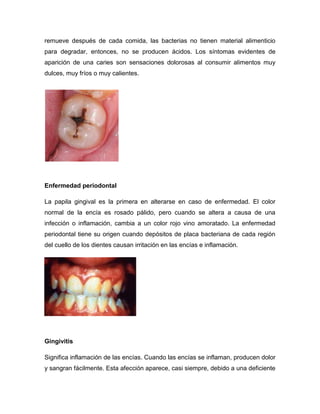 remueve después de cada comida, las bacterias no tienen material alimenticio
para degradar, entonces, no se producen ácidos. Los síntomas evidentes de
aparición de una caries son sensaciones dolorosas al consumir alimentos muy
dulces, muy fríos o muy calientes.




Enfermedad periodontal

La papila gingival es la primera en alterarse en caso de enfermedad. El color
normal de la encía es rosado pálido, pero cuando se altera a causa de una
infección o inflamación, cambia a un color rojo vino amoratado. La enfermedad
periodontal tiene su origen cuando depósitos de placa bacteriana de cada región
del cuello de los dientes causan irritación en las encías e inflamación.




Gingivitis

Significa inflamación de las encías. Cuando las encías se inflaman, producen dolor
y sangran fácilmente. Esta afección aparece, casi siempre, debido a una deficiente
 