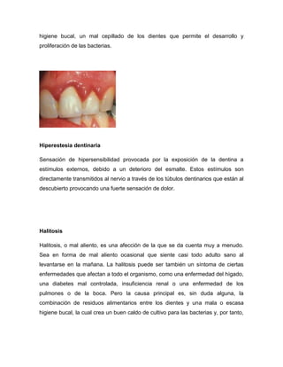 higiene bucal, un mal cepillado de los dientes que permite el desarrollo y
proliferación de las bacterias.




Hiperestesia dentinaria

Sensación de hipersensibilidad provocada por la exposición de la dentina a
estímulos externos, debido a un deterioro del esmalte. Estos estímulos son
directamente transmitidos al nervio a través de los túbulos dentinarios que están al
descubierto provocando una fuerte sensación de dolor.




Halitosis

Halitosis, o mal aliento, es una afección de la que se da cuenta muy a menudo.
Sea en forma de mal aliento ocasional que siente casi todo adulto sano al
levantarse en la mañana. La halitosis puede ser también un síntoma de ciertas
enfermedades que afectan a todo el organismo, como una enfermedad del hígado,
una diabetes mal controlada, insuficiencia renal o una enfermedad de los
pulmones o de la boca. Pero la causa principal es, sin duda alguna, la
combinación de residuos alimentarios entre los dientes y una mala o escasa
higiene bucal, la cual crea un buen caldo de cultivo para las bacterias y, por tanto,
 