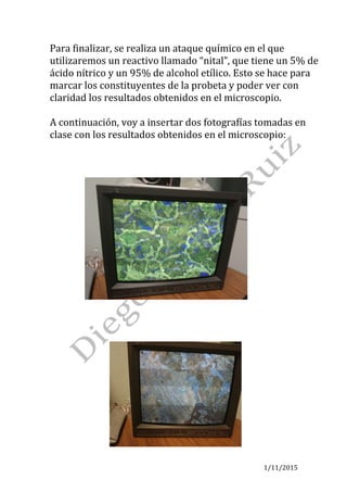 1/11/2015	
Para	finalizar,	se	realiza	un	ataque	químico	en	el	que	
utilizaremos	un	reactivo	llamado	“nital”,	que	tiene	un	5%	de	
ácido	nítrico	y	un	95%	de	alcohol	etílico.	Esto	se	hace	para	
marcar	los	constituyentes	de	la	probeta	y	poder	ver	con	
claridad	los	resultados	obtenidos	en	el	microscopio.	
	
A	continuación,	voy	a	insertar	dos	fotografías	tomadas	en	
clase	con	los	resultados	obtenidos	en	el	microscopio:	
	
	
	
	
	
																																	 	
 