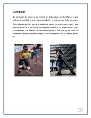 14
Conclusión
En conclusión las ortesis y las prótesis sin duda alguna han beneficiado a gran
parte de la sociedad, ya que mejoran la calidad y el estilo de vida de las personas.
Estos aparatos ayudan a suplir la función de alguna parte de nuestro cuerpo pero
además de asumir la función también ayudan a modificar los aspectos funcionales
y estructurales del sistema neuromusculoesquelético que por alguna razón se
encuentran dañados, trayendo consigo un amplio beneficio para la persona que los
usa.
 