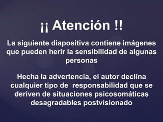 ¡¡ Atención !!
La siguiente diapositiva contiene imágenes
que pueden herir la sensibilidad de algunas
                 personas

   Hecha la advertencia, el autor declina
 cualquier tipo de responsabilidad que se
  deriven de situaciones psicosomáticas
       desagradables postvisionado
 
