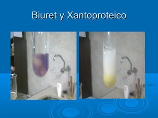 Biuret y Xantoproteico
 