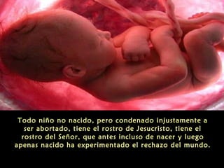 Todo niño no nacido, pero condenado injustamente a
ser abortado, tiene el rostro de Jesucristo, tiene el
rostro del Señor, que antes incluso de nacer y luego
apenas nacido ha experimentado el rechazo del mundo.
 