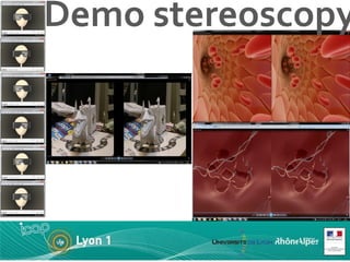 Demo stereoscopy 