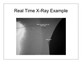 Real Time X-Ray Example
 