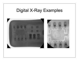 Digital X-Ray Examples
 