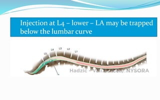 Injection at L4 – lower – LA may be trapped
below the lumbar curve
 